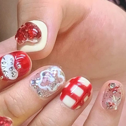 Surplus Year-After-Year